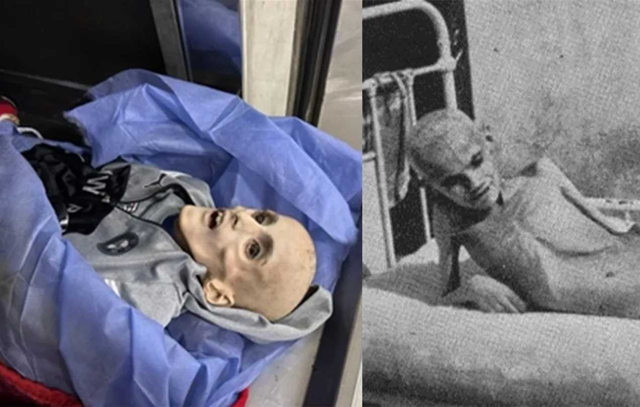 অনাহারকে অস্ত্র বানিয়ে ইসরায়েল গাজায় জাতিগত নির্মূলকরণ এবং গণহত্যা চালাচ্ছে